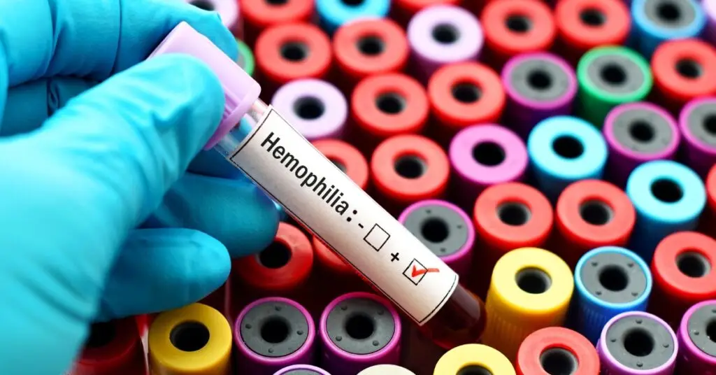Hemophilia-featured-image