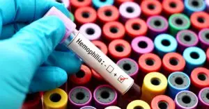 Treating Hemophilia: The Impact of New Gene Therapies